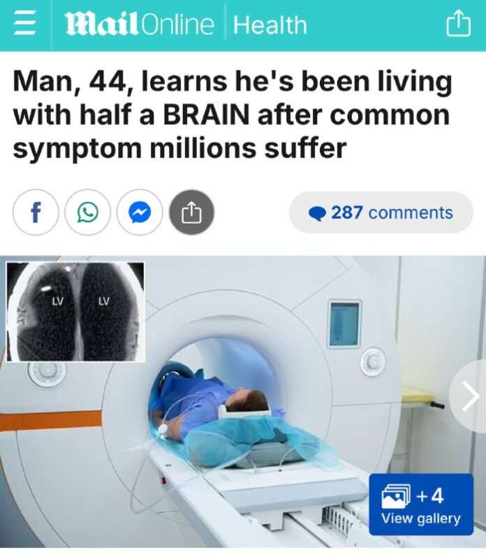 Чудные новости: француз 44 года жил без мозгов (почти). - новости