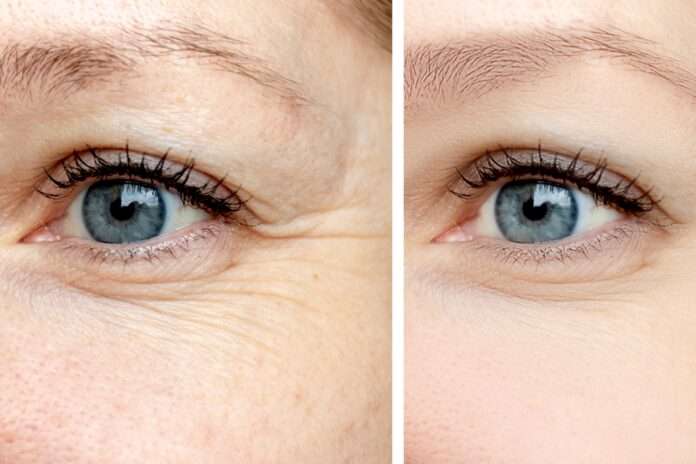 ​Генетика или образ жизни: ученые исследуют молекулярные механизмы и генетические факторы, влияющие на скорость старения... - новости