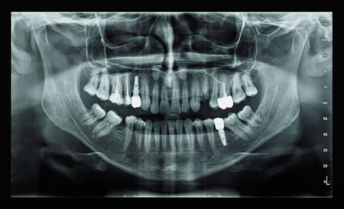 ​🦷 Японские ученые работают над препаратом, который способен стимулировать рост новых зубов у человека... - новости
