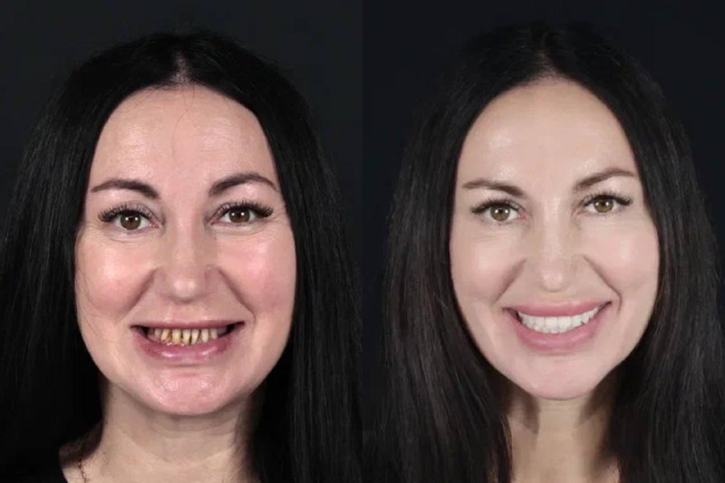 Стоматология будущего