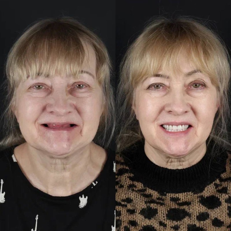 Результат до и после